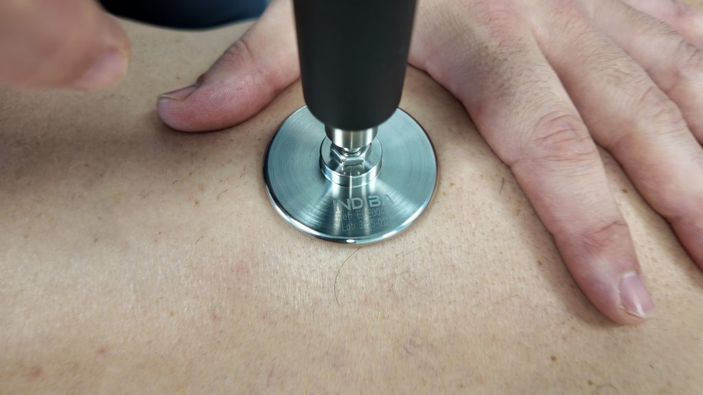 Fisioterapia dolor crónico Bezana por Ander Santa Coloma con Indiba®
